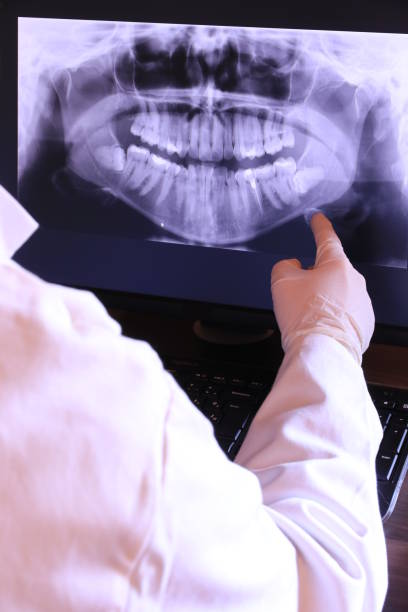 Best Knocked-Out Tooth (Avulsed Tooth) Treatment in Brentwood, PA